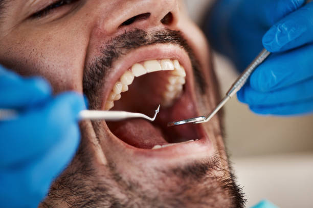 Best Broken or Cracked Tooth Emergency Dentist in Country Clu, CA